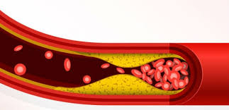 Image result for Cholesterol in blood