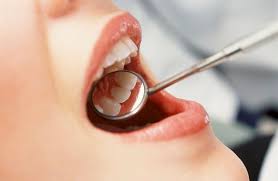 Image result for Mouth from Bacteria